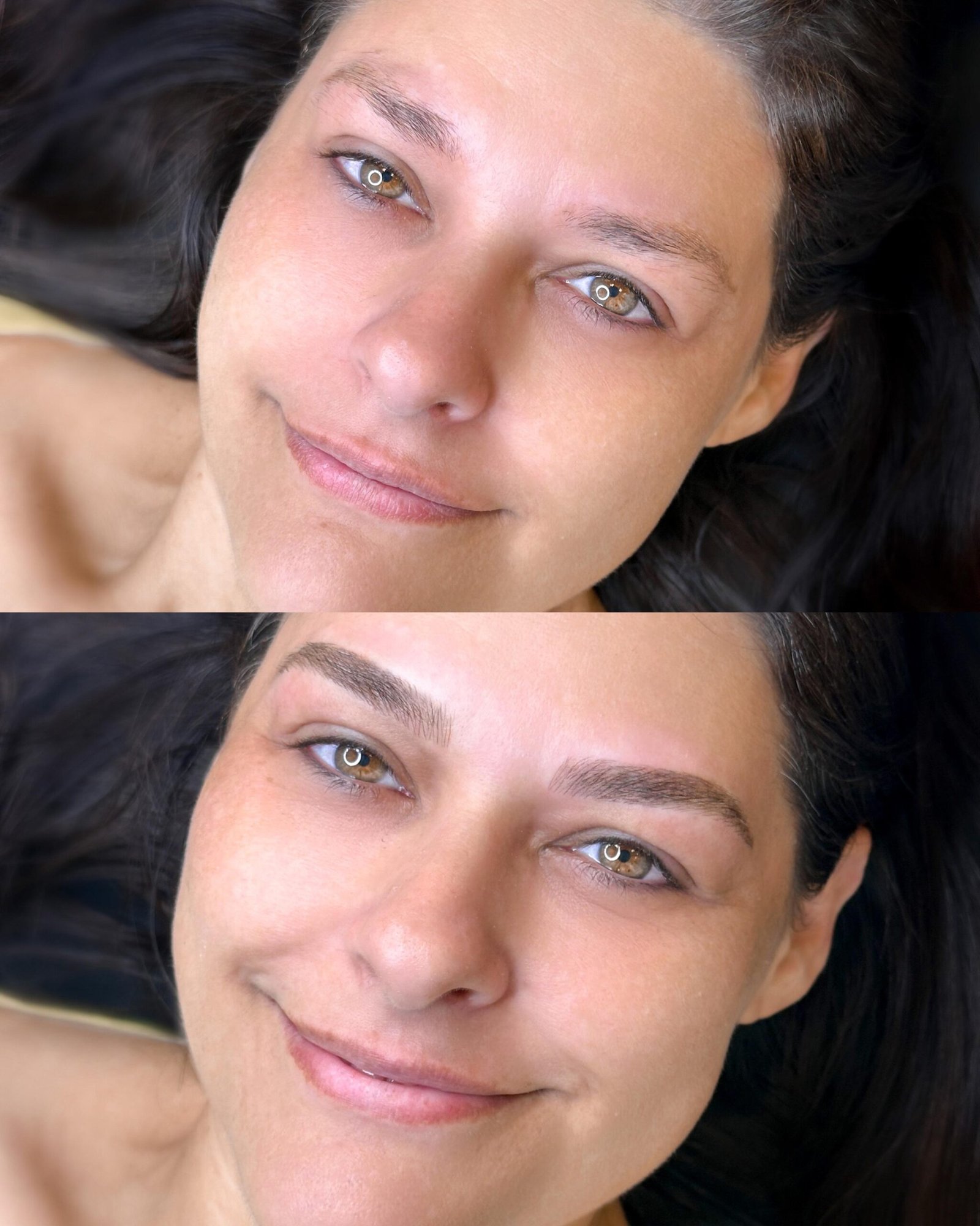 Resultado real de procedimento CM Beauty 1