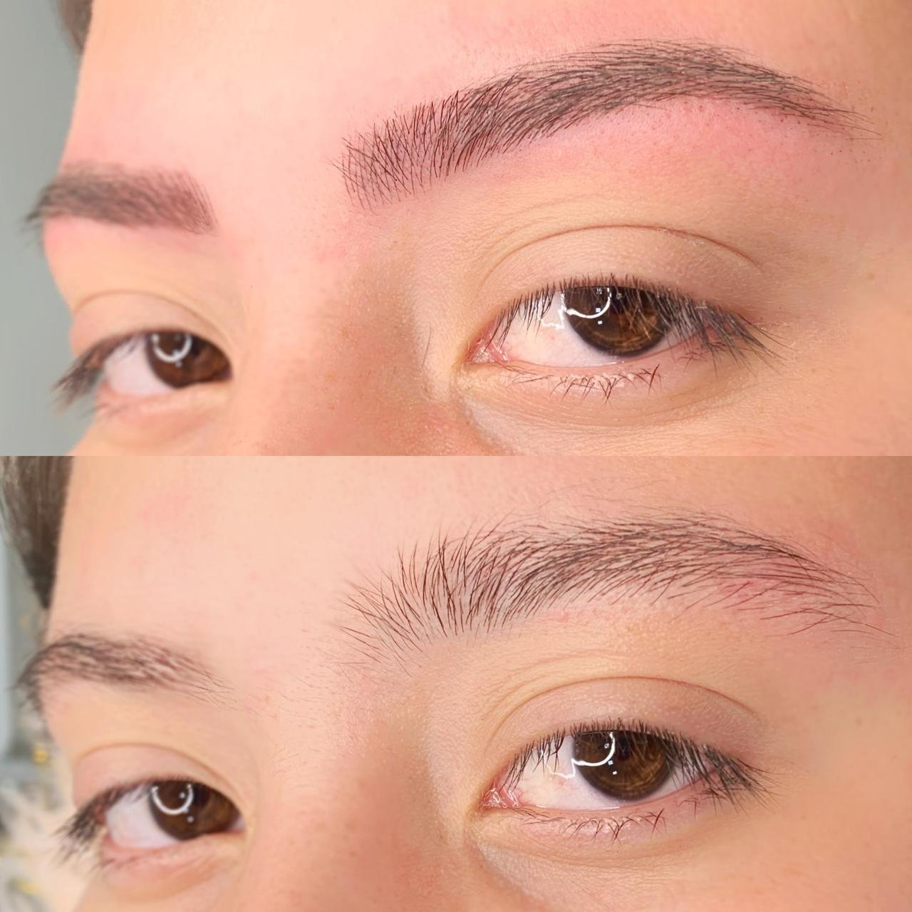 Resultado real de procedimento CM Beauty 5
